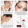 YAFUSIPE AHA 30% + BHA 2% Peeling Solution Exfoliating Chemical