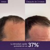 Caudalie Serum Densidad Capilar - 50 mL