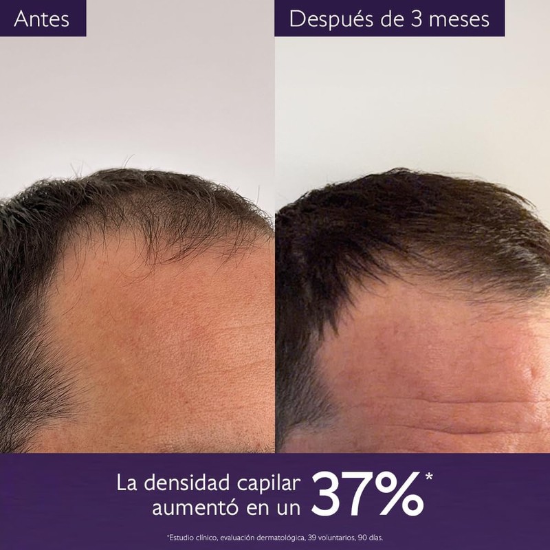 Caudalie Serum Densidad Capilar - 50 mL