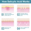 Polvo de ácido salicílico (4,58 oz130 g), ingredientes originales de