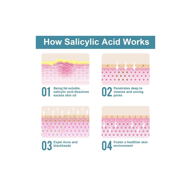 Polvo de ácido salicílico (4,58 oz130 g), ingredientes originales de