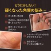 Pinpoint Smoother, Slippy Fish Sharpener, Octopus, Exfoliating Feet, Heel, Exfoliating