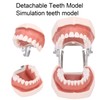 Removable tooth model, simulation tooth model restoration and insertion of