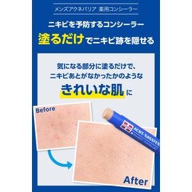 Men's Acne Barrier, Medicated Concealer 0.2 oz [5 g]