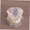 BUGUUYO Detachable Oral Model for Dental Teaching Removable Disease Teeth