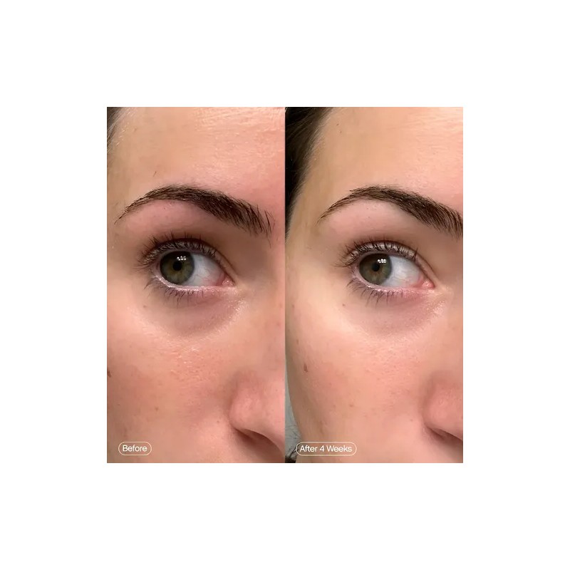 Topicals Skincare Faded Under Eye Brightening Clearing Masks
