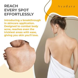 Ayadara Acne Body Spray 4oz 3-Pack Salicylic Acid Back Chest Butt Acne