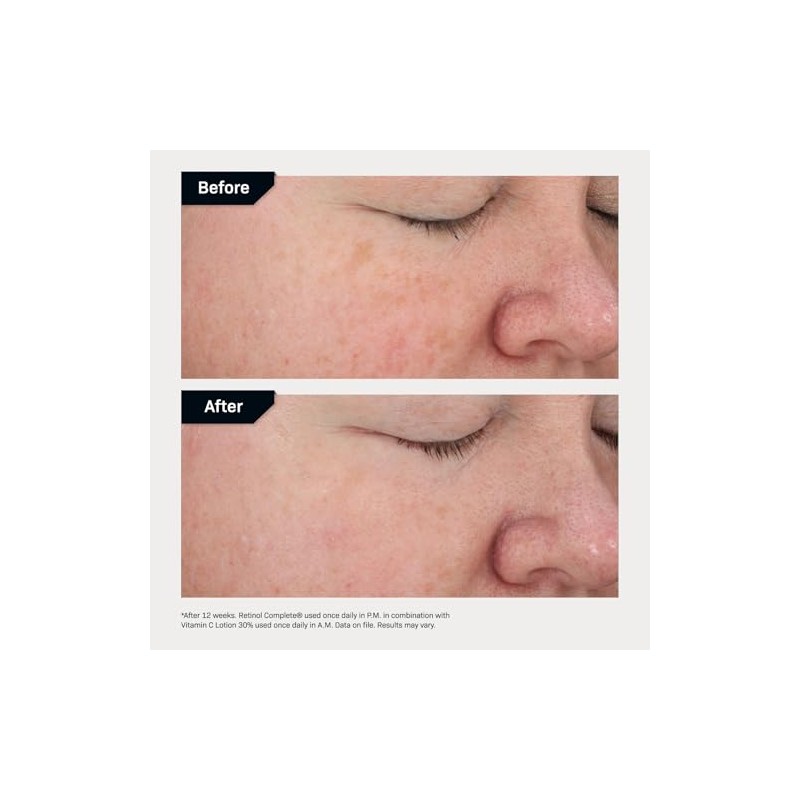 Revision Skincare Retinol Complete 0.5%, 1 oz
