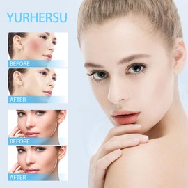 Avocado 2PC Flecken Creme,Whitening Cream,Aufhellende Creme,Whitening Cream Pigmentflecken Entferner Gesichtssprossen Creme Verbessert dunkle Flecken und Unreinheiten um den Teint zu Erhellen