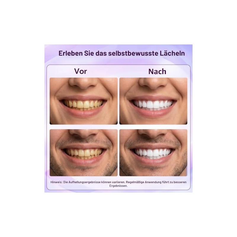 SwiftGain Teeth Whitening Strips for Sensitive Teeth - 14 Uses