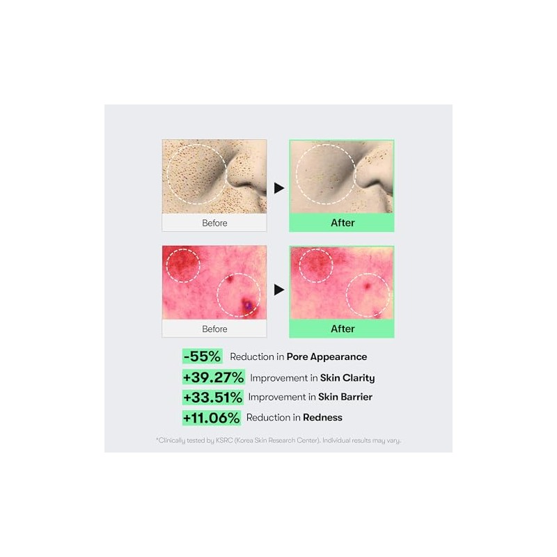 Cica Reedle Shot 100 by Vt Cosmetics for Women -