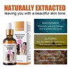 Mooyah Strong Whitening Dark Skin Knuckles Feets Knees Elbows Armpit