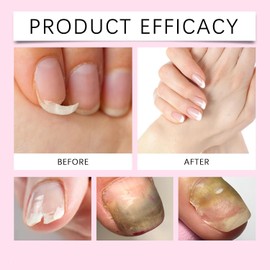 Lápiz de aceite para cutículas con empujador de cutículas de cerámica, lápiz para el cuidado de las uñas para remover padrastros y reparar cutículas, lápices aceites removedores cutículas suave (4PCS)