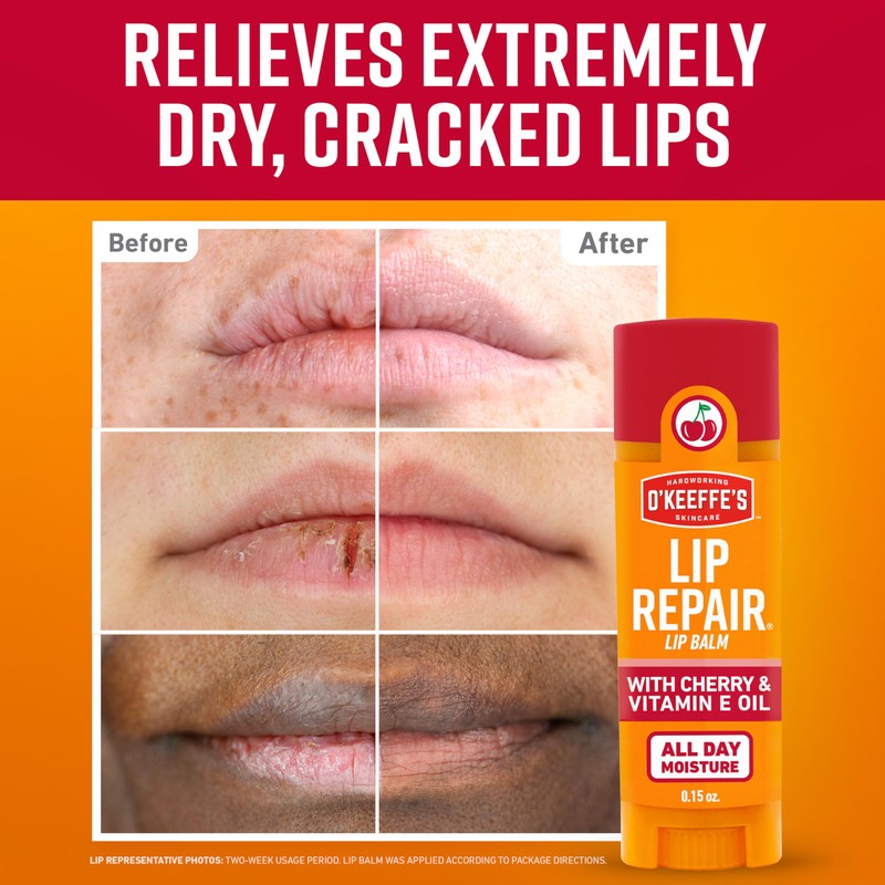 O'Keeffe's Lip Repair Lip Balm with Cherry & Vitamin E