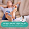 Welnove 12-Pack Gel Pinky Toe Separators - Little Toe Spacers