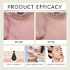 Pore-Clearing Green Tomato Clay Mask with Extract. Deep Cleanses, Dries