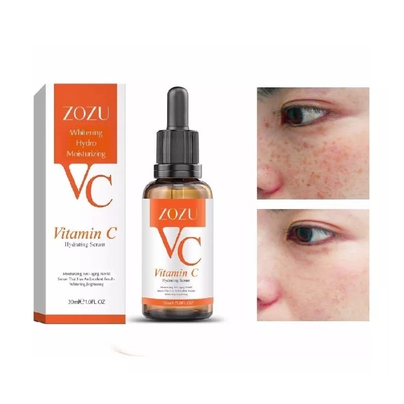 Zozu Serum C Original Elimina Manchas Pecas Paño Piel Uniforme