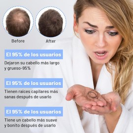 Suero para el crecimiento del cabello con péptidos de cobre Péptidos de Cobre para Cabello, Péptidos de Cobre Avanzados Universales para Mujeres y Hombres (2 piezas)