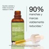 Sérum facial antiacné y antimanchas para piel grasa con acido
