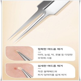 제거기 압출기 피지 제거용 핀셋으로 흉터없이 깨끗하게 제거 Extractor Pore Extractor Tweezers for Clean Removal Without Scars
