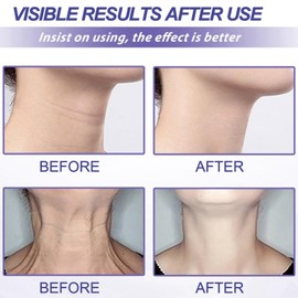 Joro/ndy Anti-Wrinkle Skin Cream for Remove Wrinkles,Face Firming Cream Tightening Lifting Sagging Skin,Antiwrinkle Face Cream,Power Lift Plumping Cream,Firming & Tightening Face Crea/m for Women