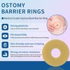 Ostomy Barrier Rings - Ostomy Supplies - 2 mm Thickness