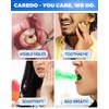 CAREDO Cavity Repair Toothpaste Cure Tooth Cavities Dental Caries Remineralizing