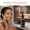 Walker Facial Essence Moisturizer, 2Pcs