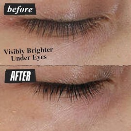 Kiehl’s Avocado Eye Treatment - Crema Contorno para Ojos Hidratante, Reduce Bolsas e Ilumina la Mirada. Con Aceite de Aguacate, Manteca de Karité, Bet