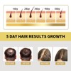 100ml Ginger Hair Regrowth Shampoo Dandruff Removal Itching Relief Deep