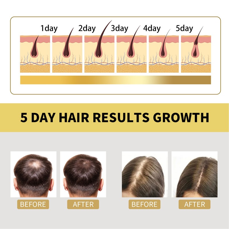 100ml Ginger Hair Regrowth Shampoo Dandruff Removal Itching Relief Deep