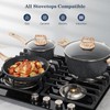 SODAY 12 Pcs Pots and Pans Set Non Stick, Cookware