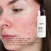 Kosei Vita-b3 Serum Facial Antimanchas, Niacinamida 10% 30ml