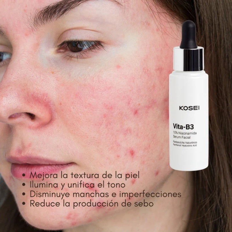 Kosei Vita-b3 Serum Facial Antimanchas, Niacinamida 10% 30ml