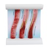 Lipoprotein LDL Blood Vessel Model Low Density Blood Lipid Vessel