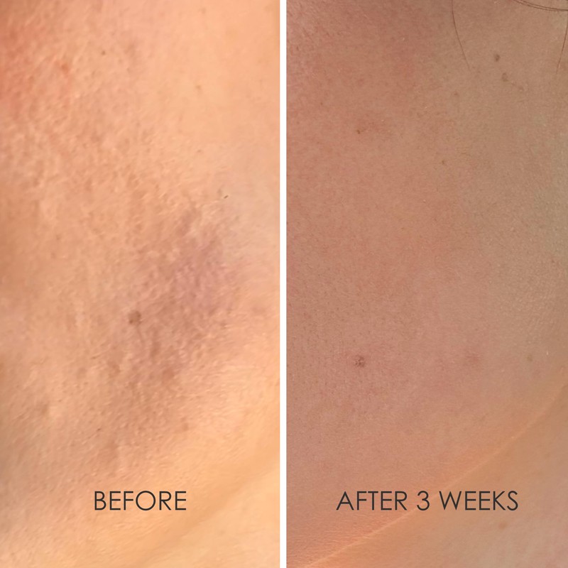 REFLEKT 3 Power Peptide Sculpting Face Cream