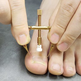 Ingrown toenail corrector ingrown toenail self-treatment tape band set RX-55 / 내성발톱 교정기 내향성발톱 자가치료 테이프 밴드 세트 RX-55