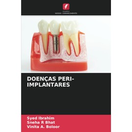 DOENÇAS PERI-IMPLANTARES