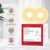 Moldable Ostomy Barrier Rings - Barrier Rings for Ostomy Bags
