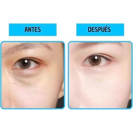60 Parches Ojos Acido Hialuronico, Mascarilla Para Ojeras Y Bolsas, Contorno De Ojos, Hidrogel Anti Arrugas, Lineas De Expresion, Hinchazon, Parches H