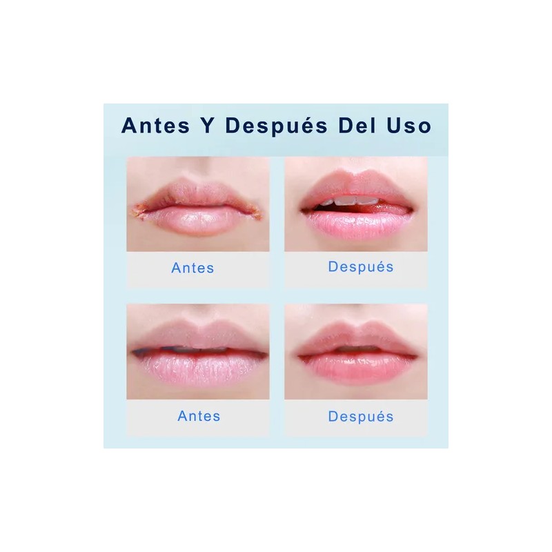 Protector Labial Reparador Labial Labios Secos Y Pelados 20g