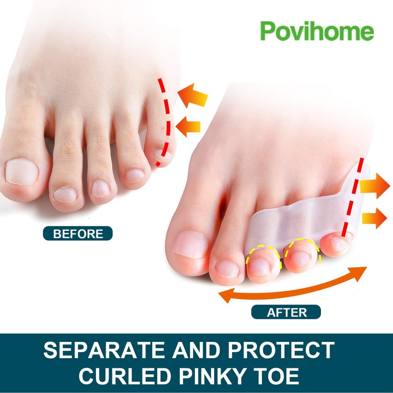 Povihome 10 Pack Pinky Toe Separator and Protectors, Triple Gel