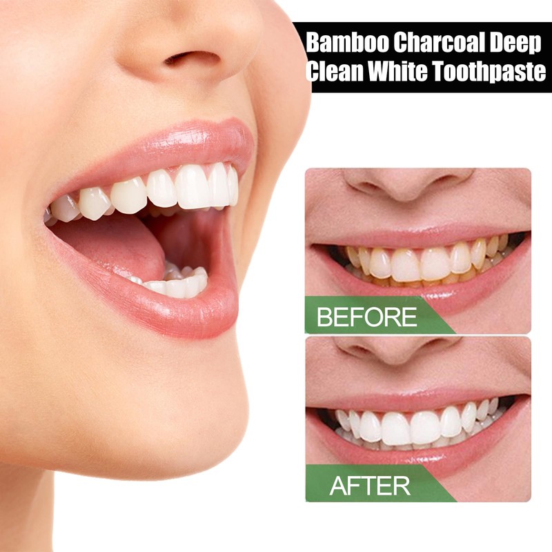 Dyceittdia Bamboo Charcoal Toothpaste, Bamboo Charcoal Deep Teeth Whitening Toothpaste
