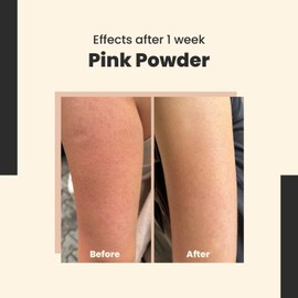 Pink Pow(D) Er – Limpiador En Polvo Enzimático Multifuncional Con Ácido Salicílico, Polvo De Arroz Y Arcilla – Limpiador Facial, Exfoliante Y Mascarilla 3 En 1 – Vegano, 40 G / 1.41 Fl. Oz