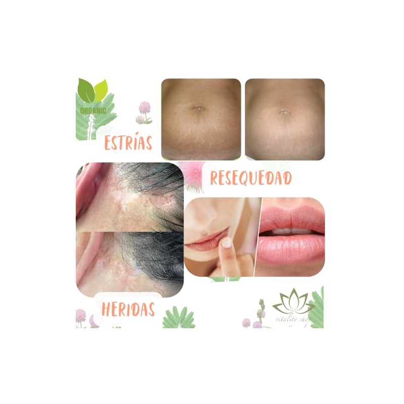 Bálsamo Orgánico Corporal Ozonizado Tepezcohuite, Vitamina E