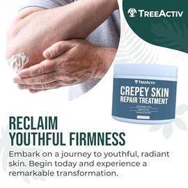 TreeActiv Tratamiento reparador de piel Crepey, fórmula original, 8 fl oz, crema reafirmante para rostro y cuello, loción reafirmante para la piel con