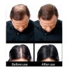 Sevich 25gr. Bote Fibras Capilares Calvicie Cabello Barba