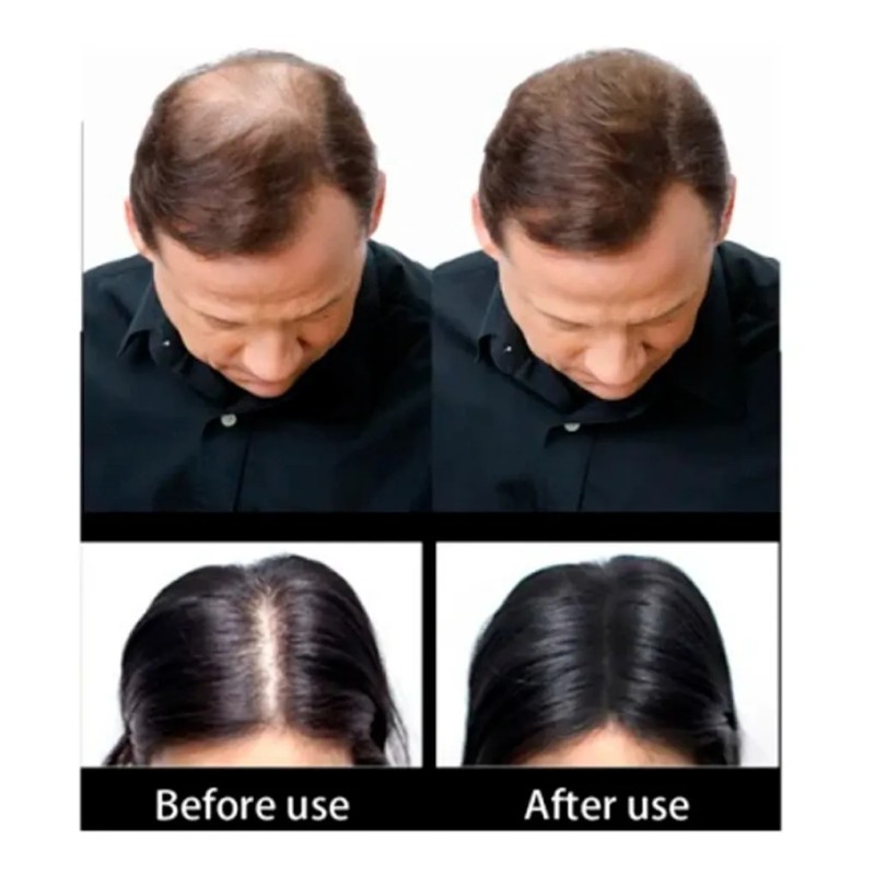 Sevich 25gr. Bote Fibras Capilares Calvicie Cabello Barba