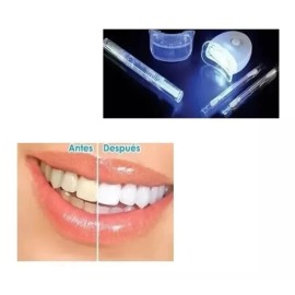 Blanqueador Dental Dientes Blancos Sonrisa Perfecta