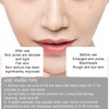 Electric Hot Compress Blackhead Acne Removal Machine Face Pore Cleaner